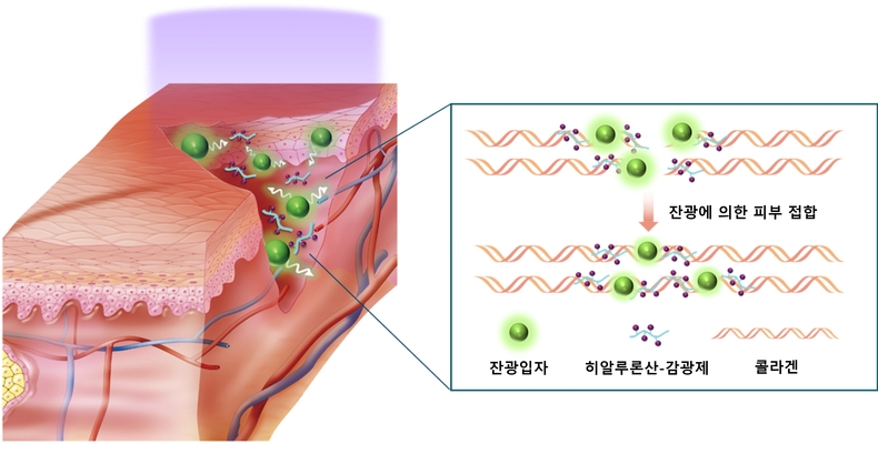 잔광입자피부접합. (사진=POSTECH 제공)